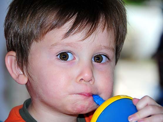 feeding disorders in children